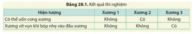 KHTN 8 Bài 28: Hệ vận động ở người