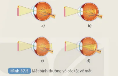 KHTN 8 Bài 37: Hệ thần kinh và các giác quan ở người