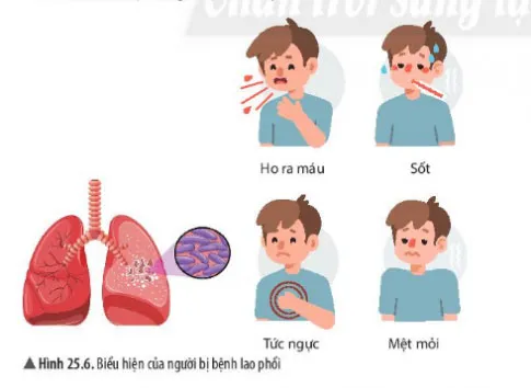 KHTN Lớp 6 Bài 25: Vi khuẩn