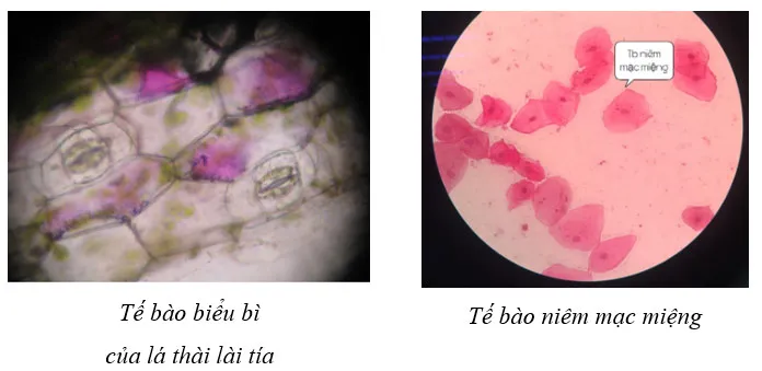 Sinh học 10 Bài 10: Thực hành Quan sát tế bào