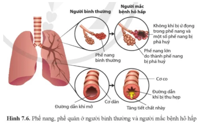 Sinh học 11 Bài 7: Hô hấp ở động vật