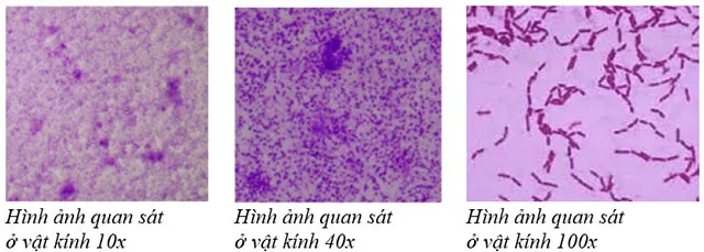 KHTN Lớp 6 Bài 28: Thực hành: Làm sữa chua và quan sát vi khuẩn